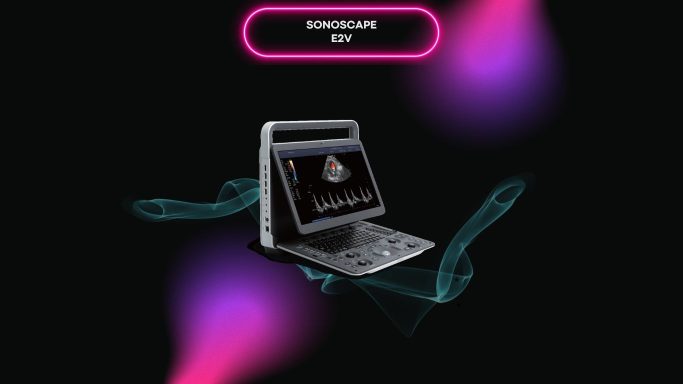 SonoScape E2V
