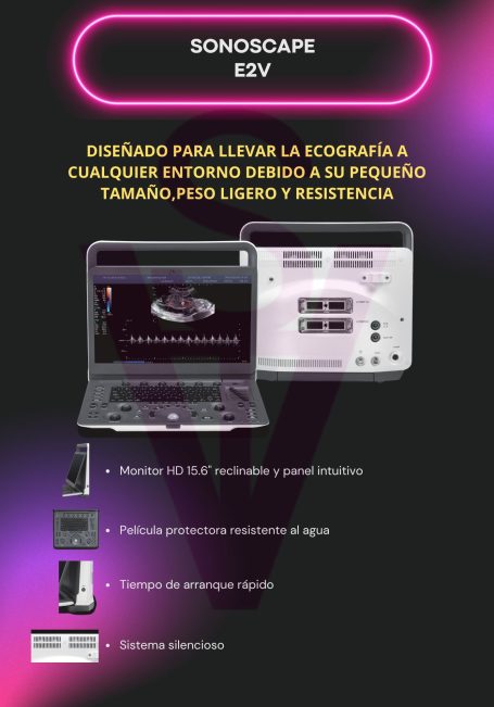Sonoscape E2V